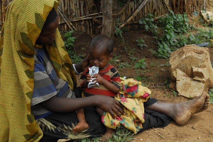 equipos médicos distribuyen nutrición terapéutica para tratar desnutrición infantil en comunidades rurales de Etiopía
